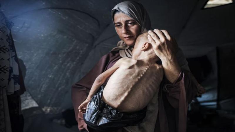 Famine and Malnutrition Claim 15 More Lives in War-Torn Gaza, Including 4 Children